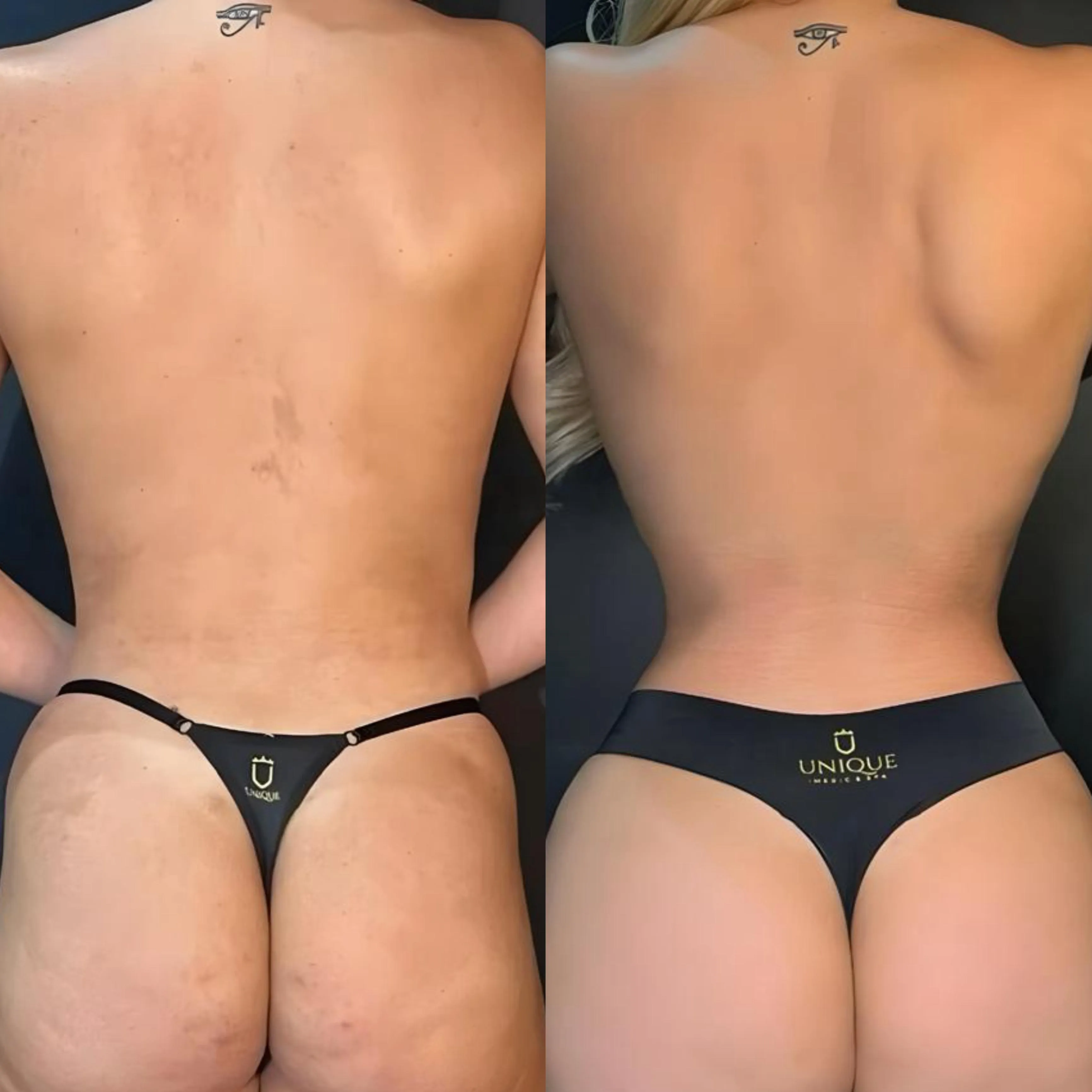 Antes e depois — resultado real